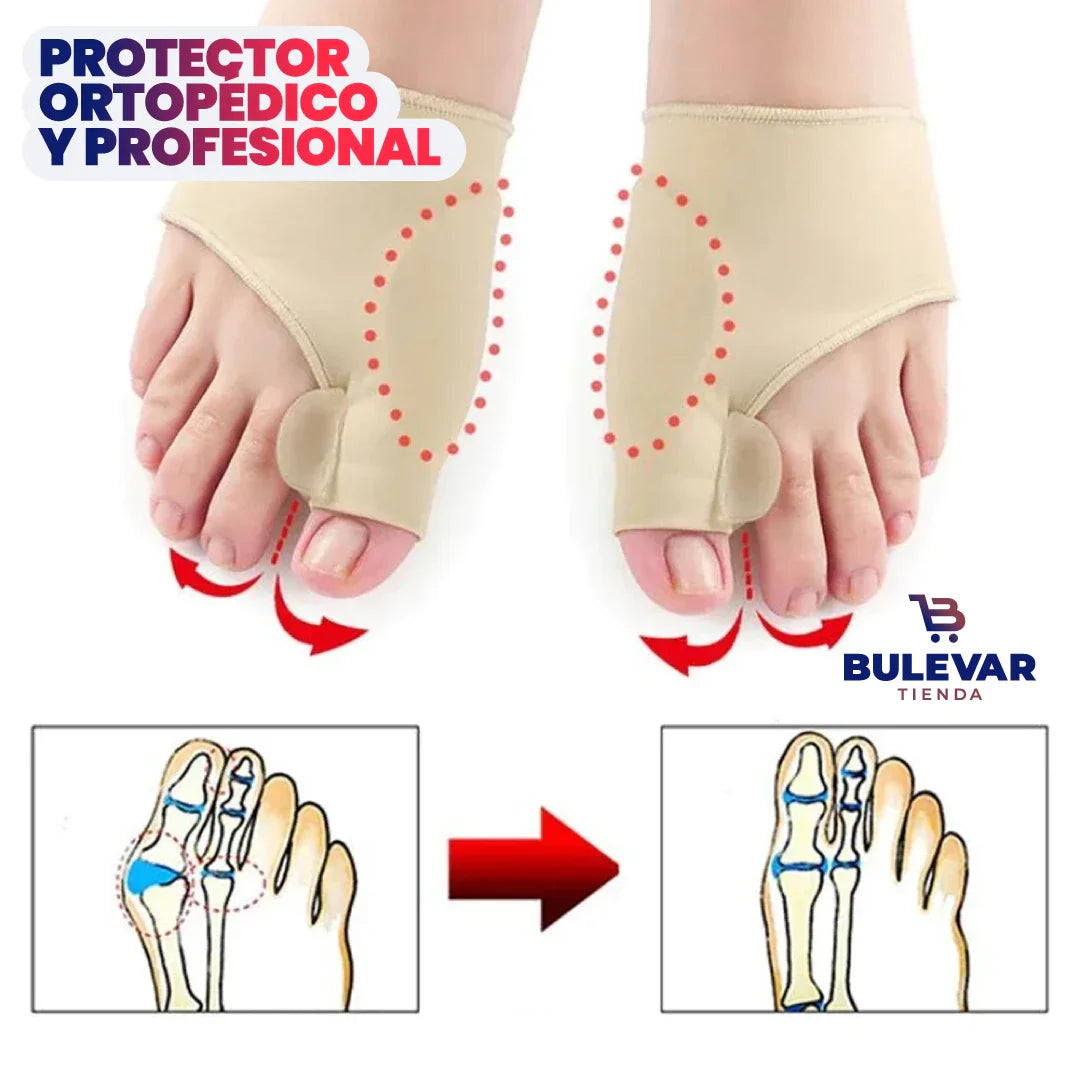 OLVÍDATE DEL DOLOR 🦶- CORRECTOR ORTOPÉDICO DE JUANETES