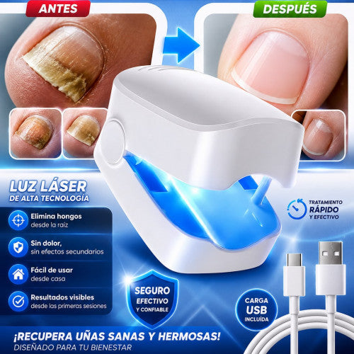 Laser Para Hongos en Uñas - Adiós a los Hongos desde casa 🦶😷