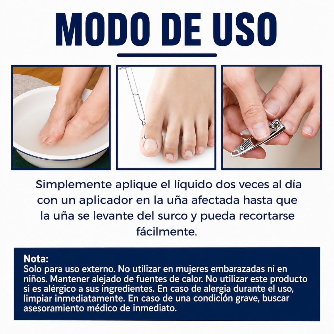 ACEITE PARA UÑA ENCARNADA 2x1🦶 — Alivia el dolor, ablanda el tejido y corrige la uña desde la raíz sin cirugía
