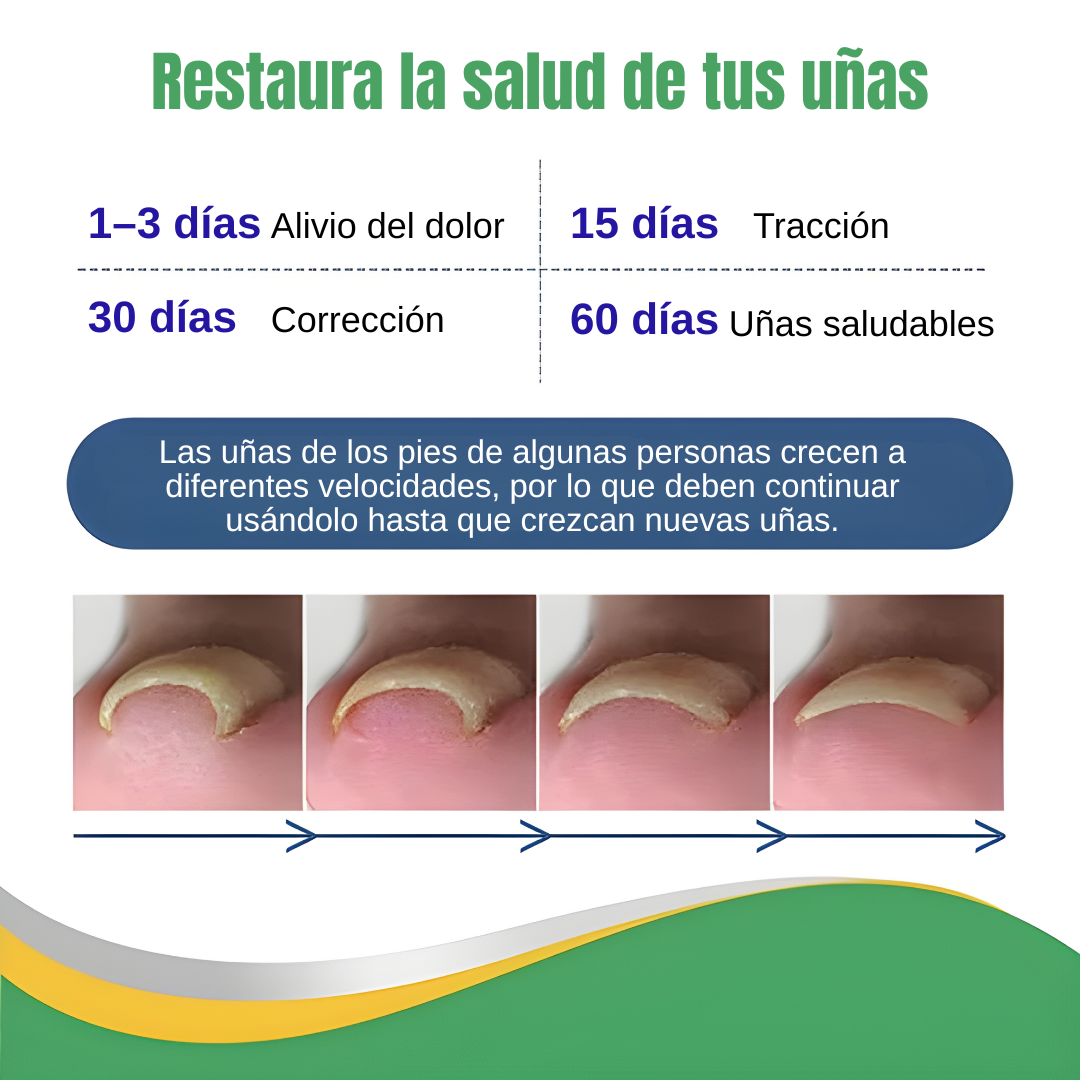 2x1 PARCHE REPARADOR DE UÑA – PROTEGE Y RECUPERA UÑAS ENCARNADAS